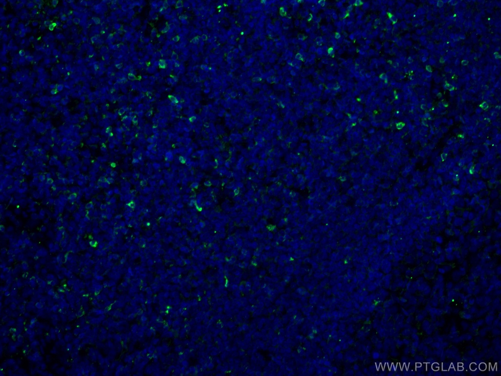 Granzyme K Monoclonal antibody