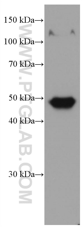 Biglycan Monoclonal antibody