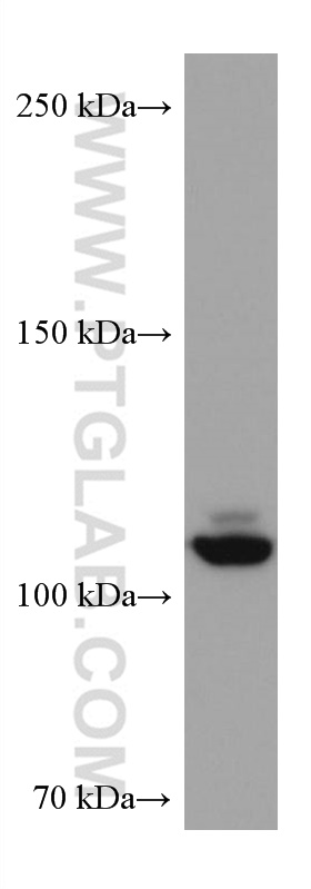 NEDD4L Monoclonal antibody