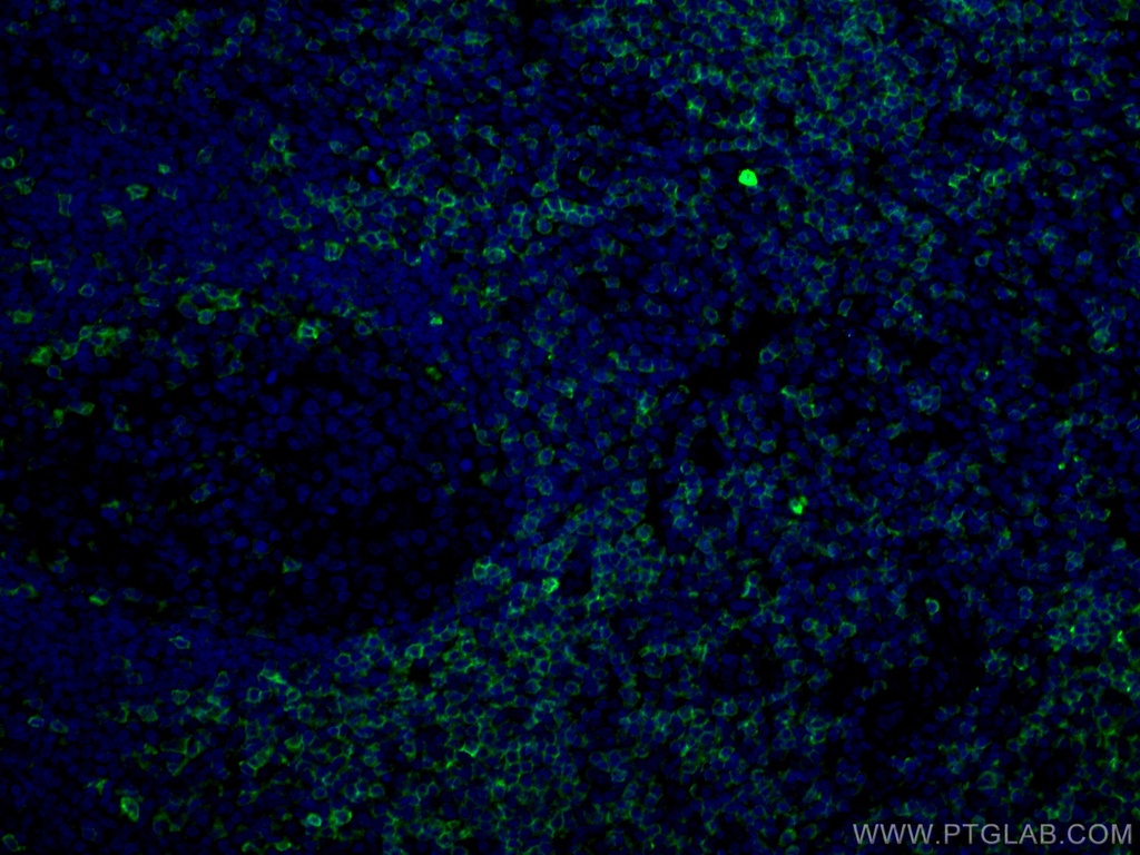 CD5 Monoclonal antibody