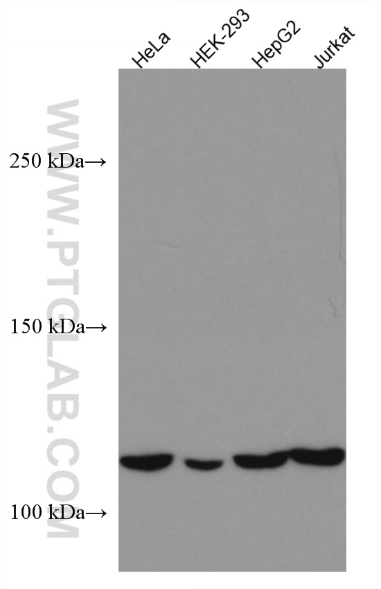 DAAM1 Monoclonal antibody
