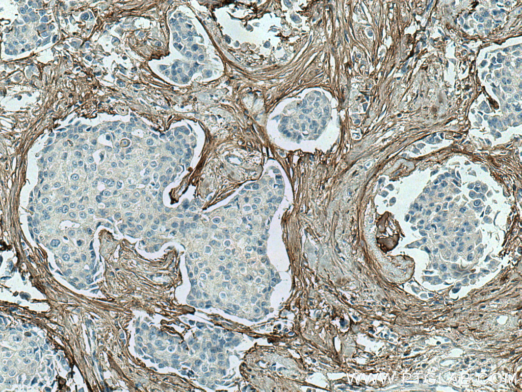 Collagen Type I Monoclonal antibody