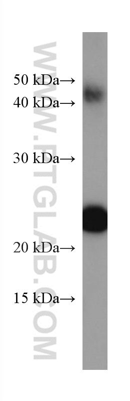 luciferase Monoclonal antibody