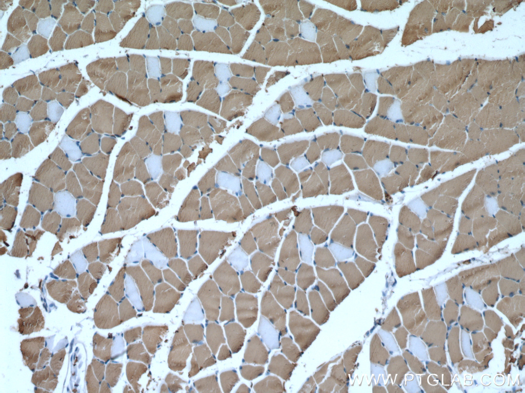 MYH1 Monoclonal antibody
