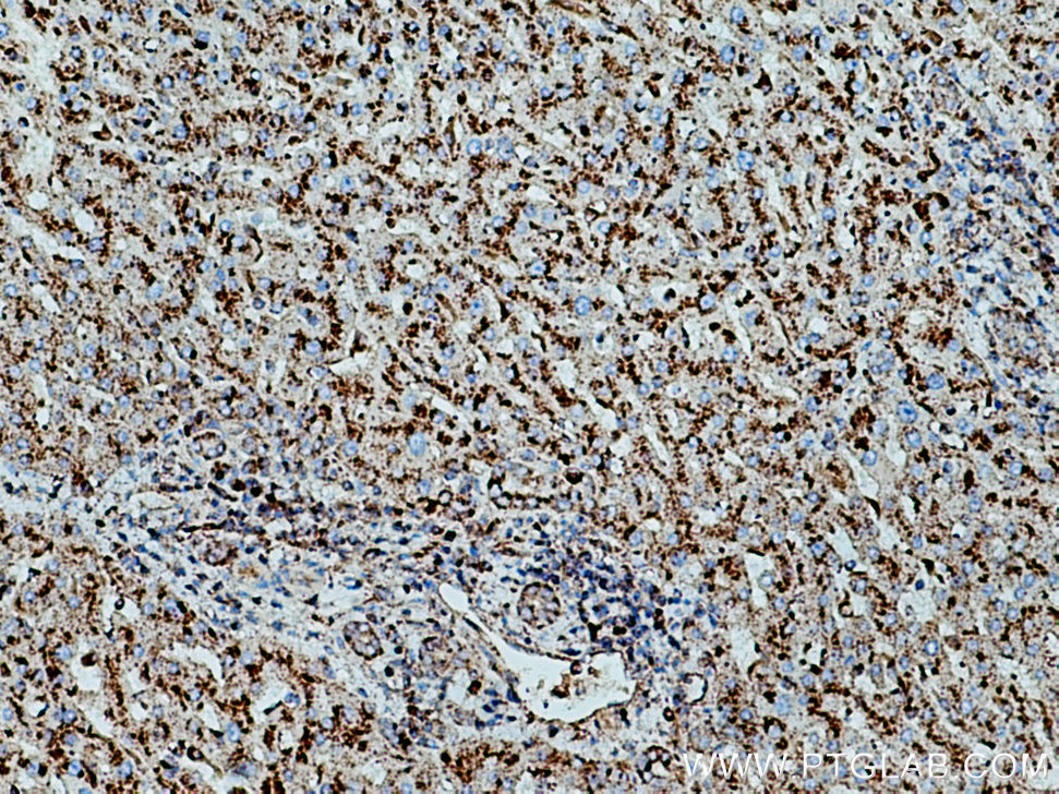 CD107a Monoclonal antibody