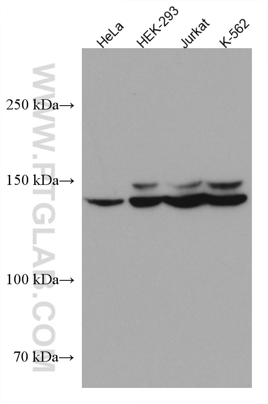 FANCI Monoclonal antibody
