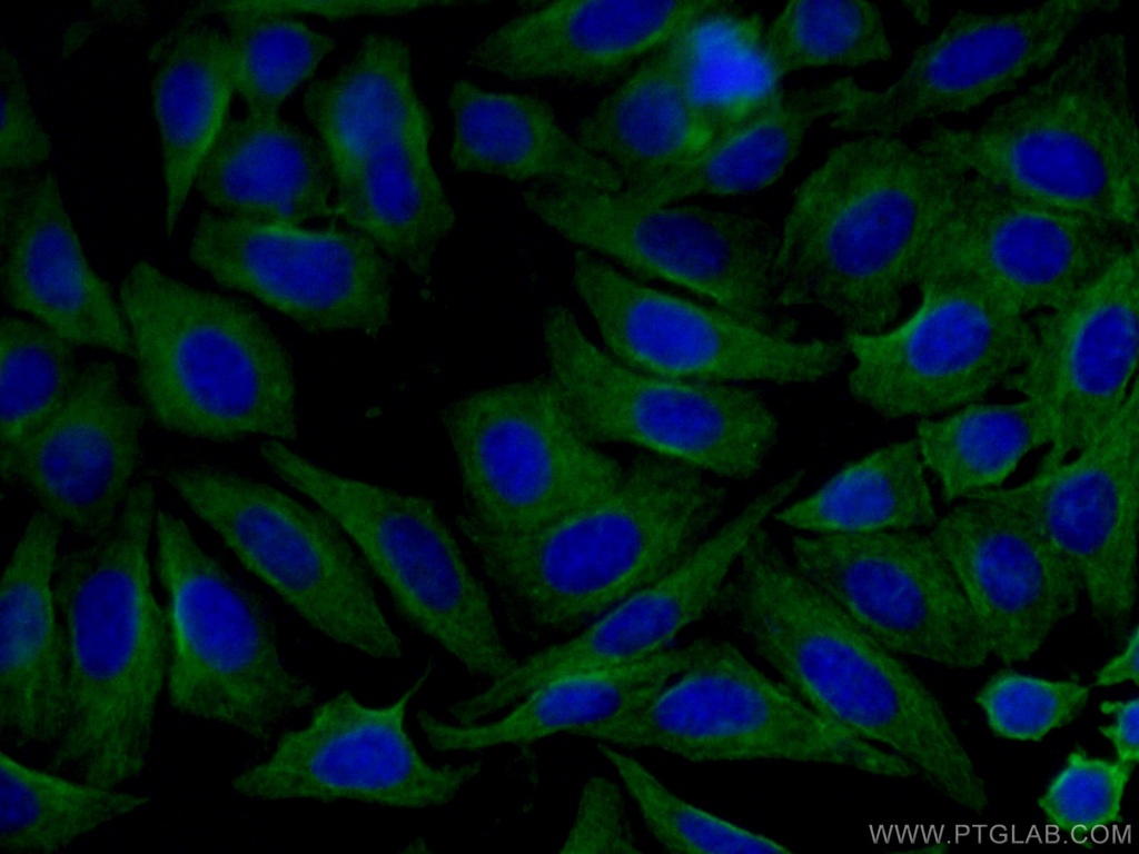 Alpha 2-Antiplasmin Monoclonal antibody