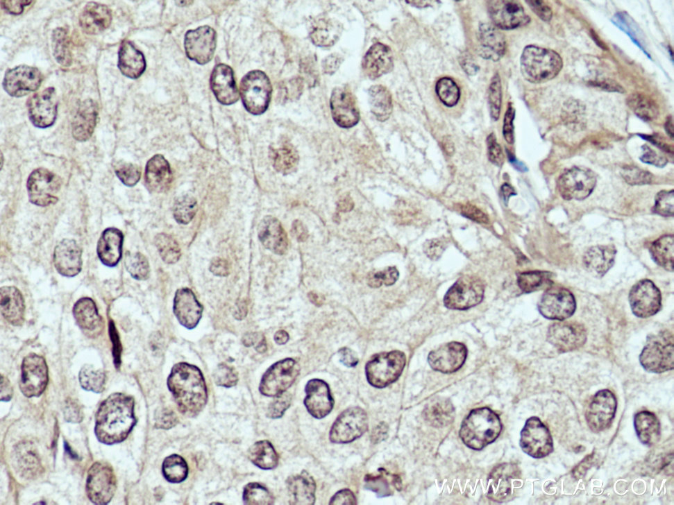 DCPS Monoclonal antibody