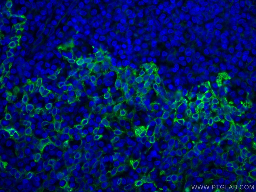TLR8 Monoclonal antibody