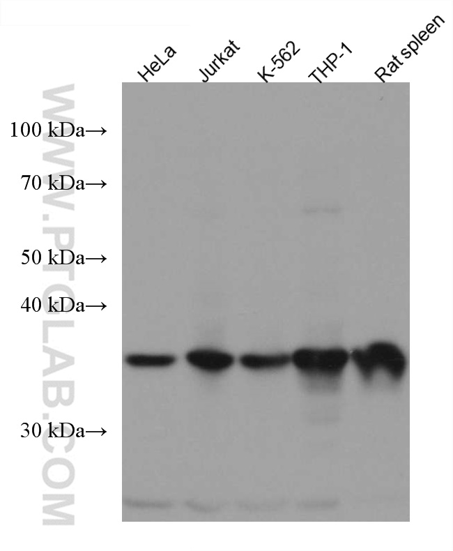 ARPC1B Monoclonal antibody