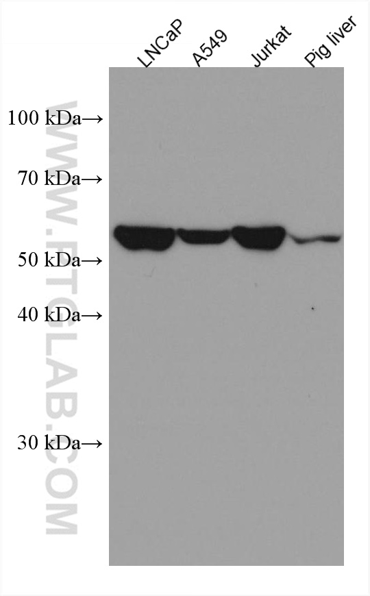 EPHX2 Monoclonal antibody
