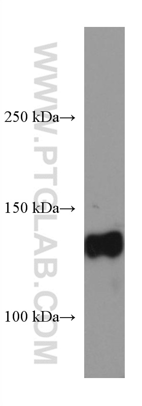 KL Monoclonal antibody