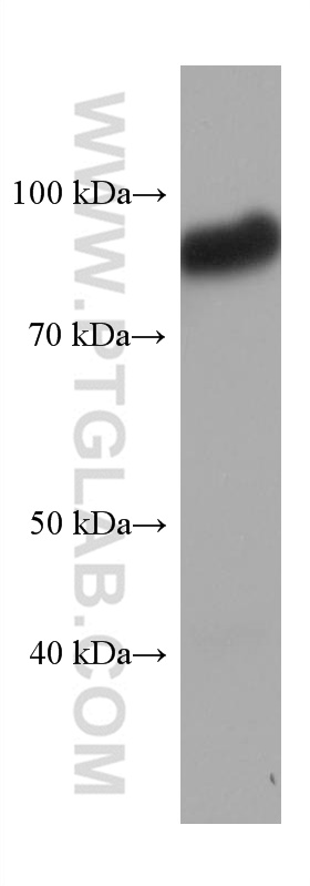 SIRP Alpha Monoclonal antibody