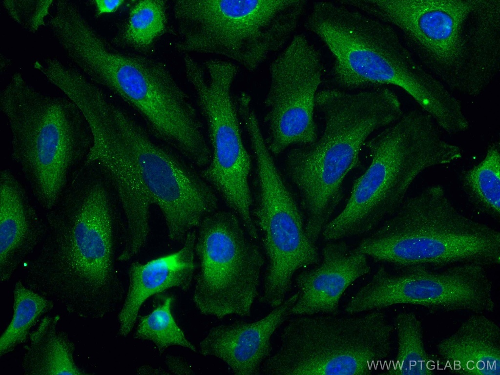 PSMD9 Monoclonal antibody