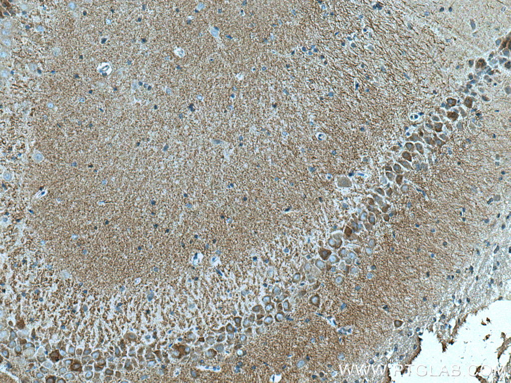 SYNPO Monoclonal antibody