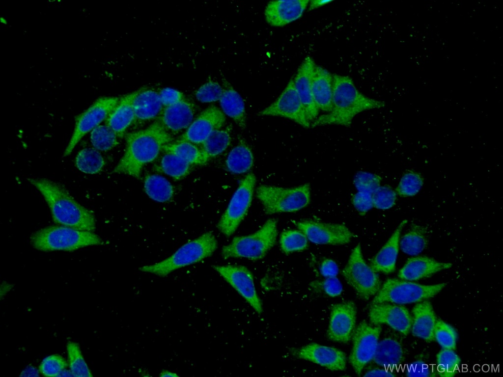ATG7 Monoclonal antibody
