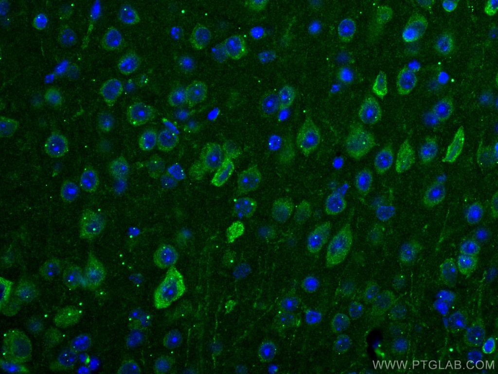 TRIM2 Monoclonal antibody