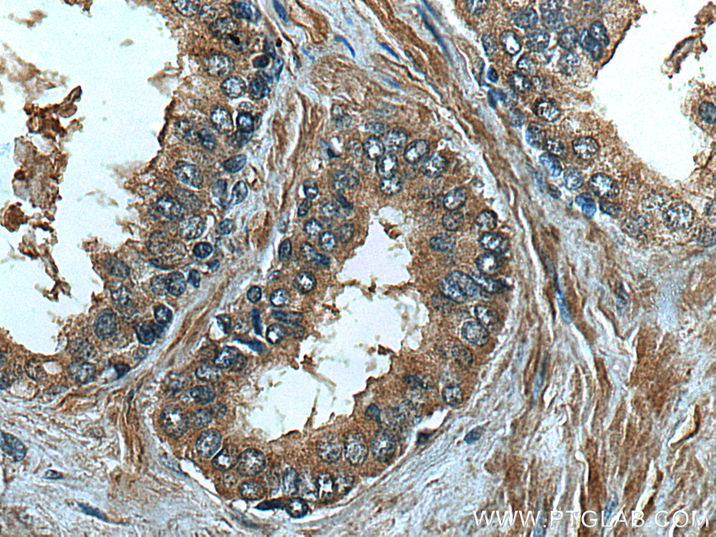 FUT3 Monoclonal antibody