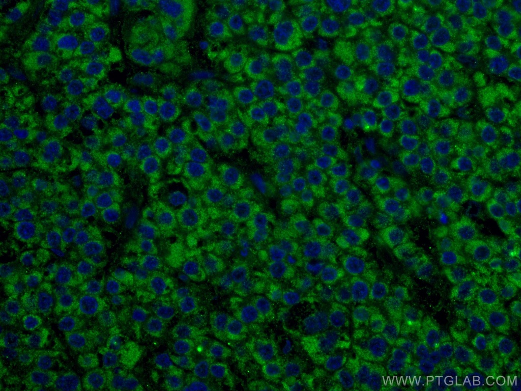 ALDH5A1 Monoclonal antibody