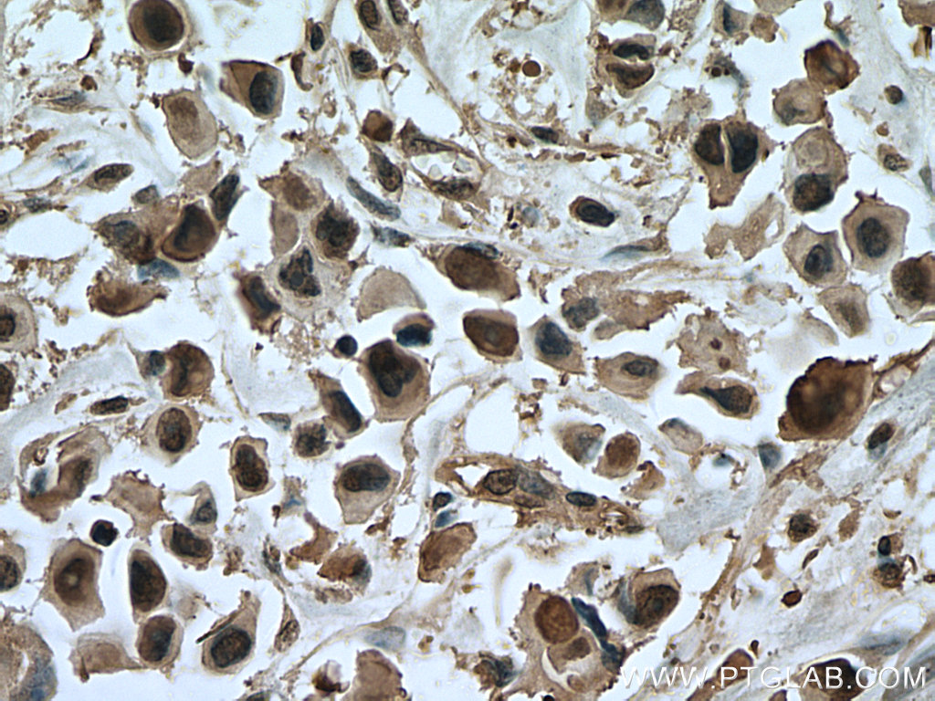 ANAPC5 Monoclonal antibody