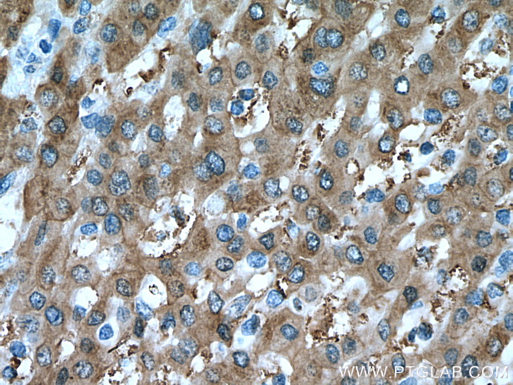 UGDH Monoclonal antibody