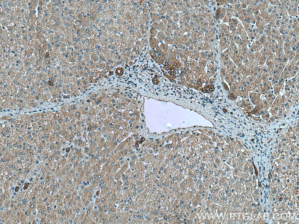NHE1 Monoclonal antibody