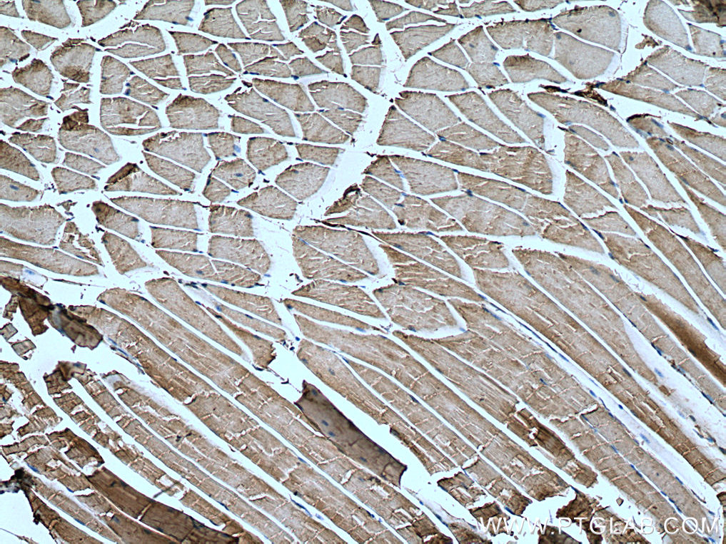 CAPN3 Monoclonal antibody