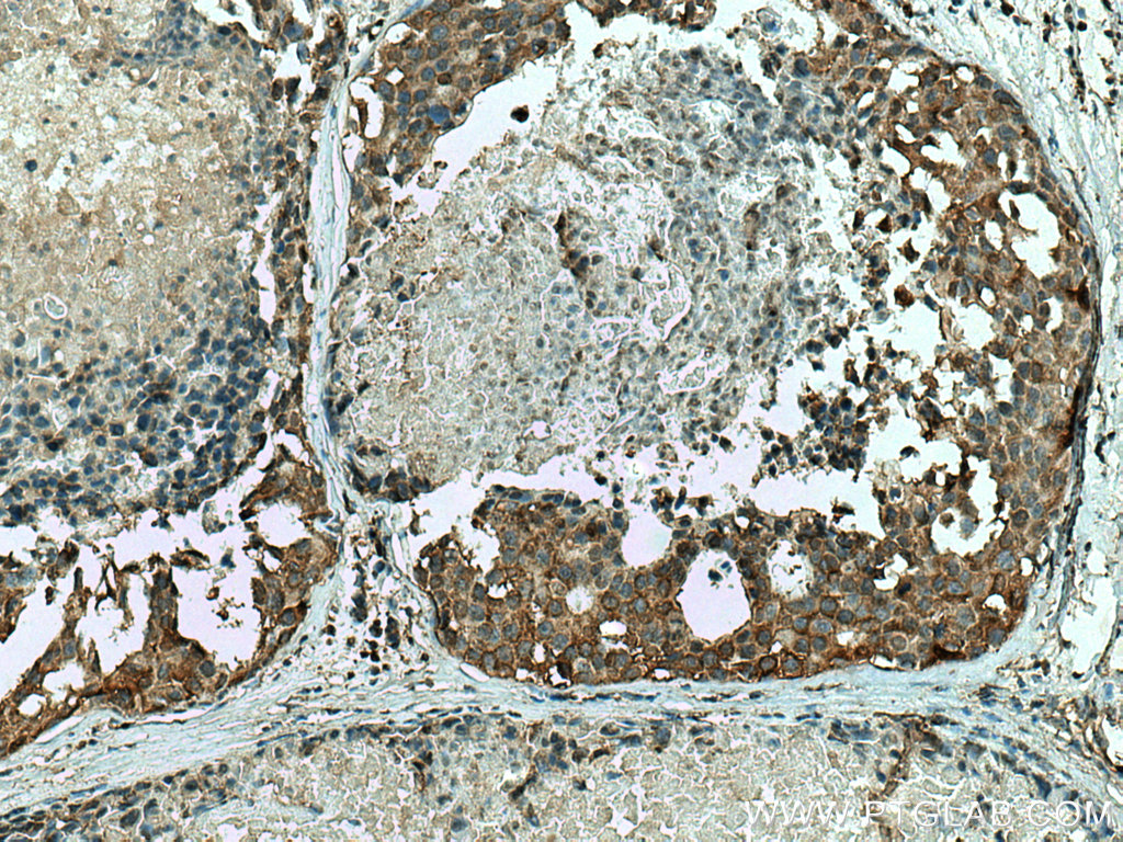ALDH9A1 Monoclonal antibody