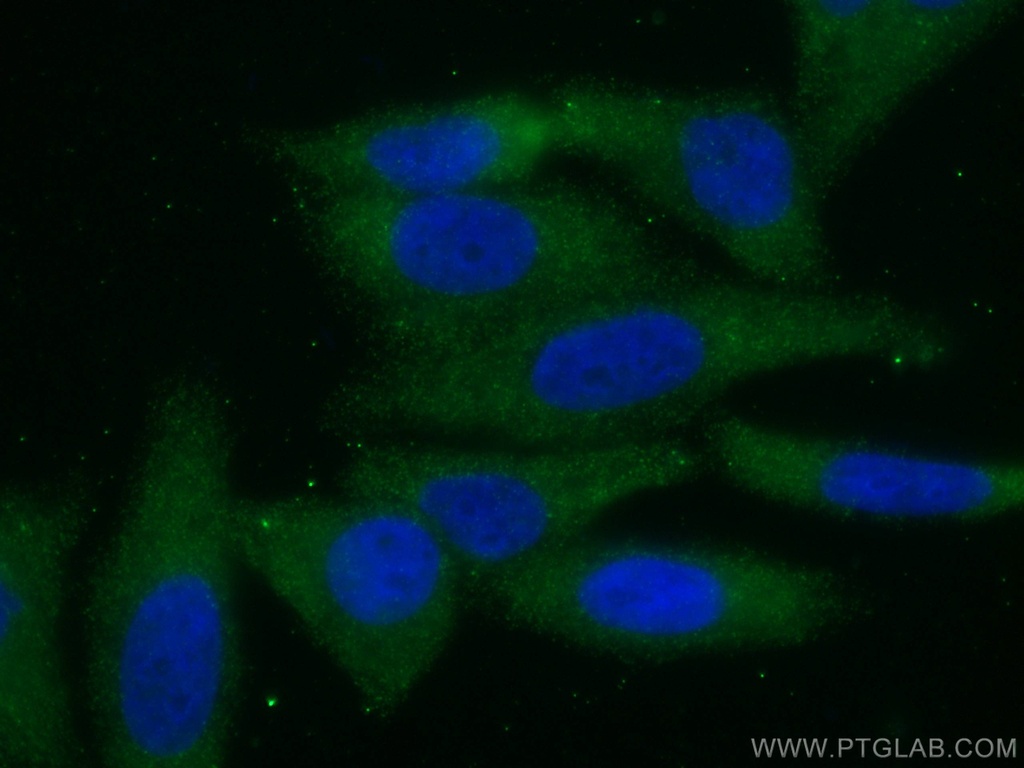ACC Monoclonal antibody
