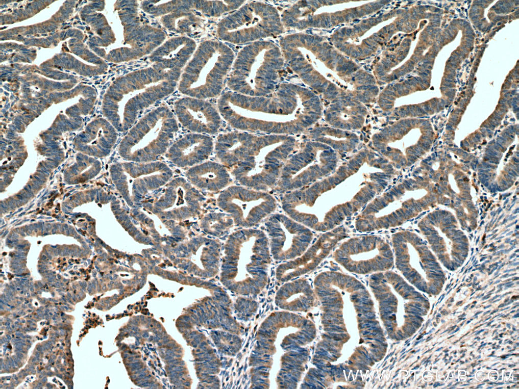 HOMER2 Monoclonal antibody