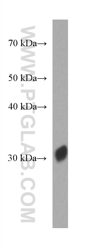 Red fluorescent protein Monoclonal antibody