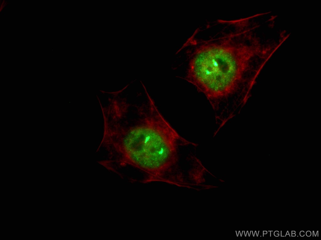 TH1L Monoclonal antibody