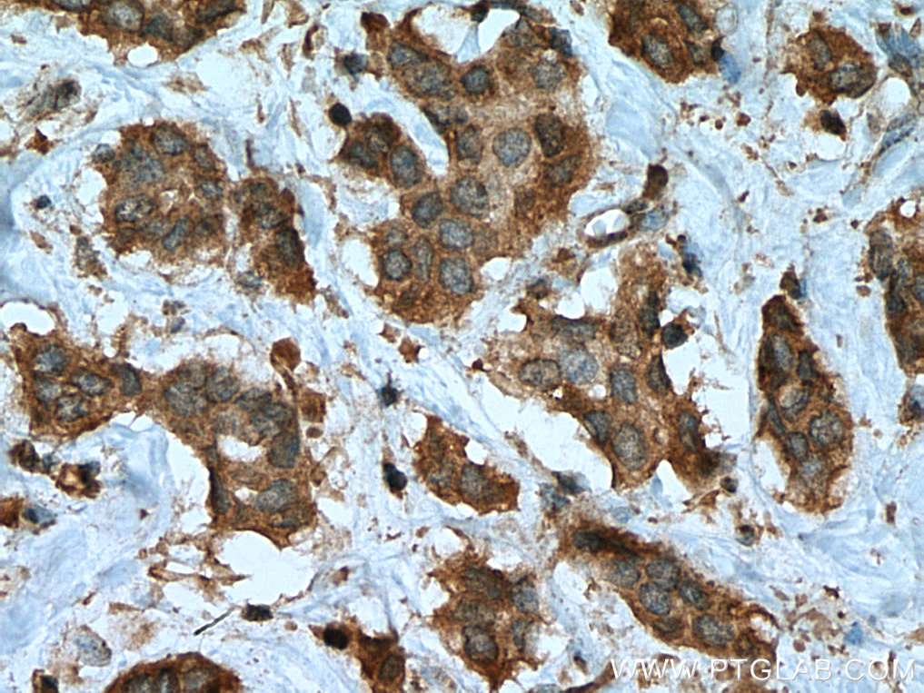 PTPN2 Monoclonal antibody