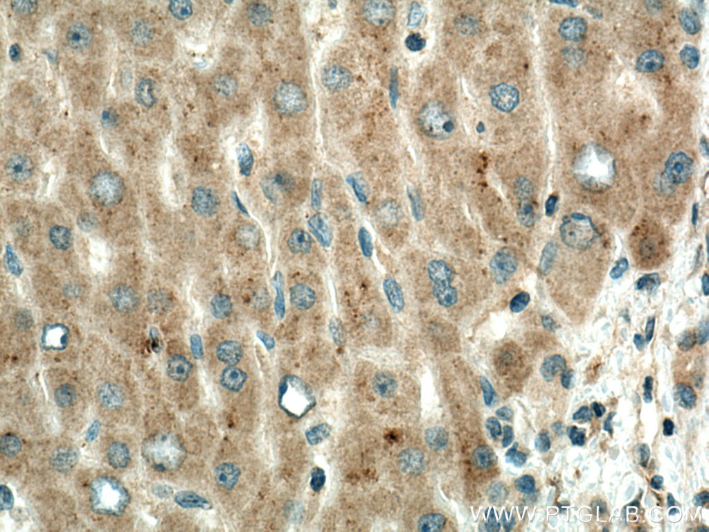 PPP4R1 Monoclonal antibody