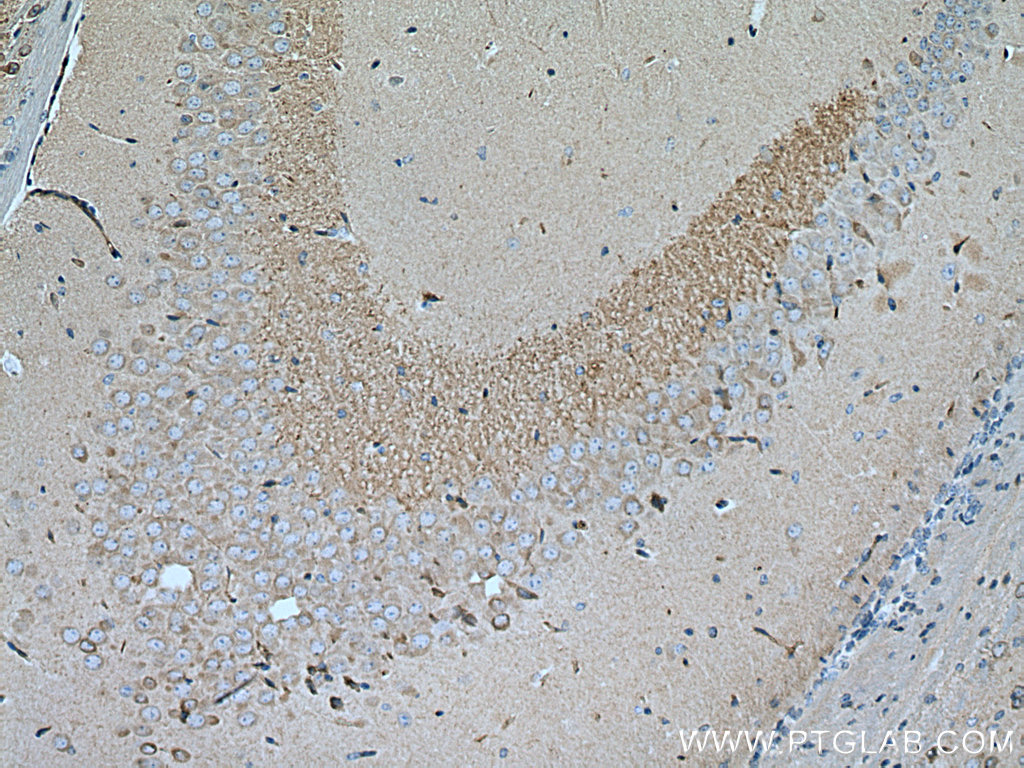 RGS14 Monoclonal antibody