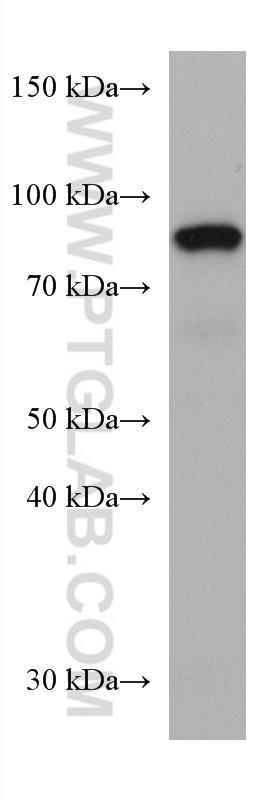 SEMA7A Monoclonal antibody