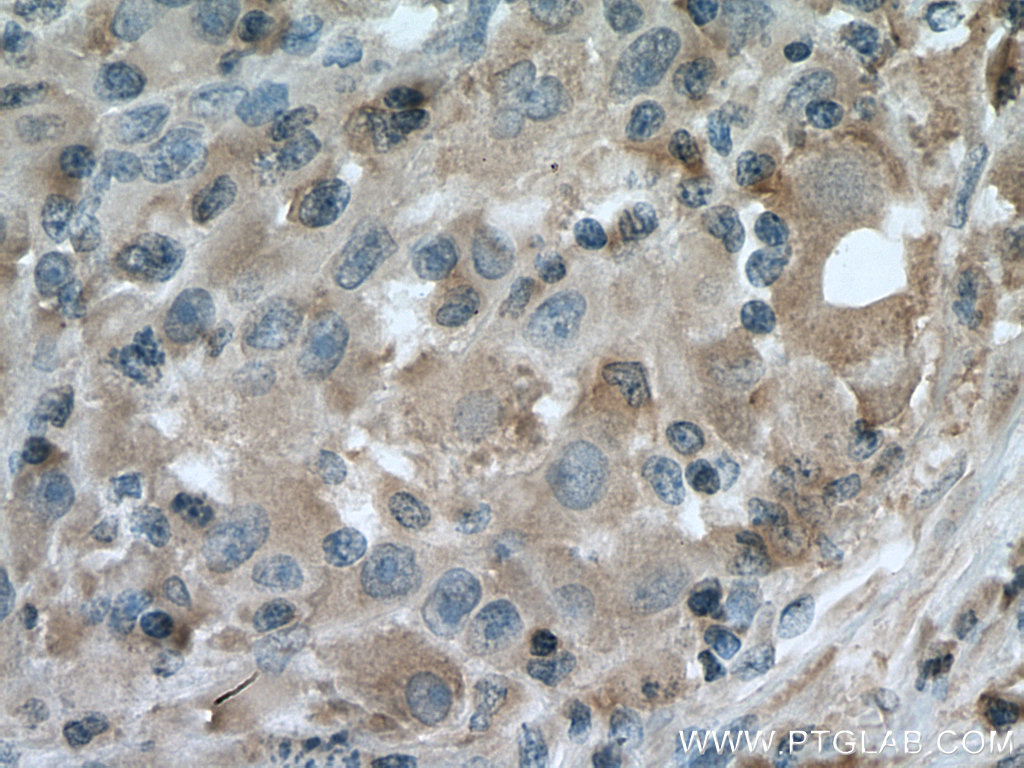 Caspase 4 Monoclonal antibody