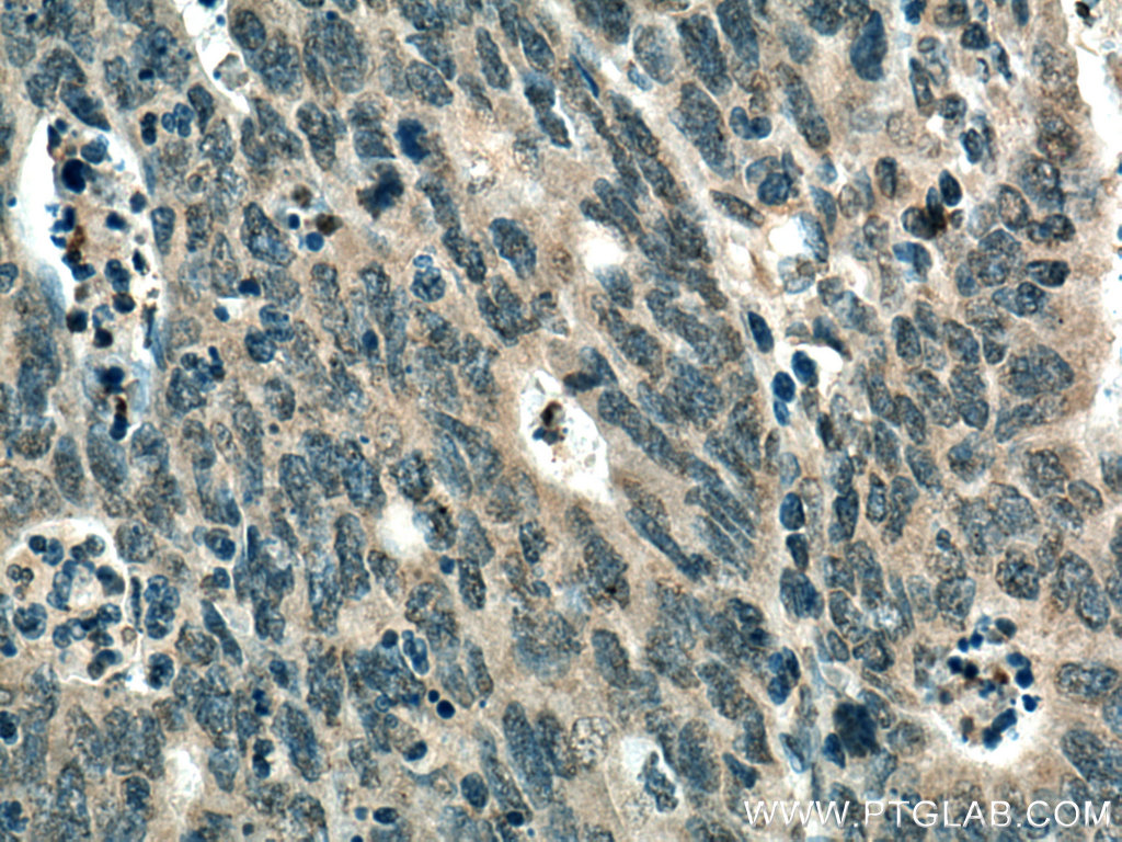 TYK2 Monoclonal antibody