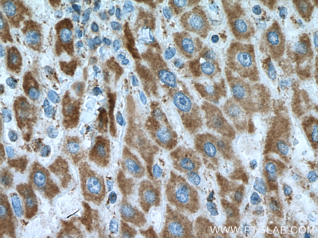 GRIM19 Monoclonal antibody