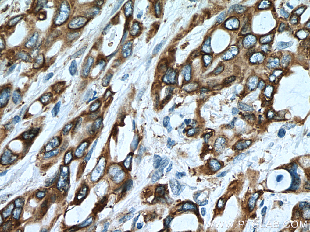 ERO1L Monoclonal antibody