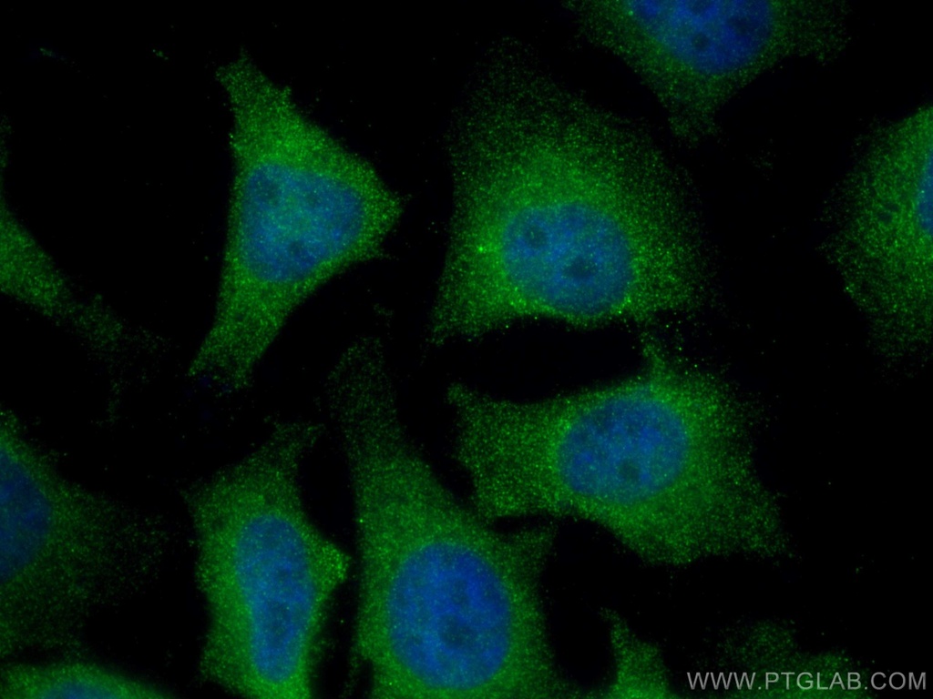 CDCA5 Monoclonal antibody
