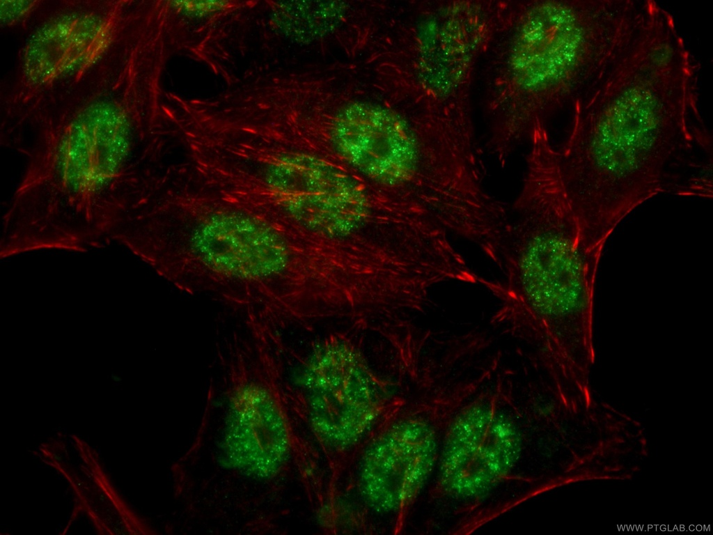 RBM39 Monoclonal antibody
