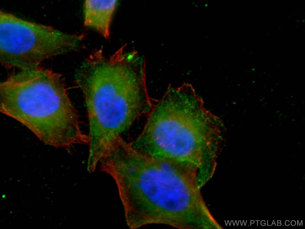 PPM1D Monoclonal antibody