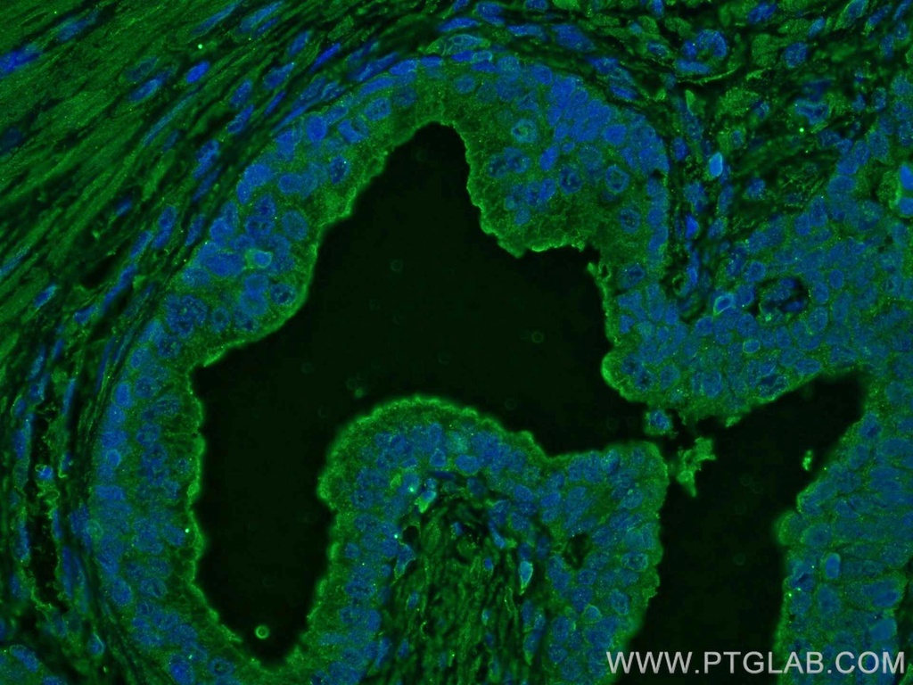 TAOK3 Monoclonal antibody