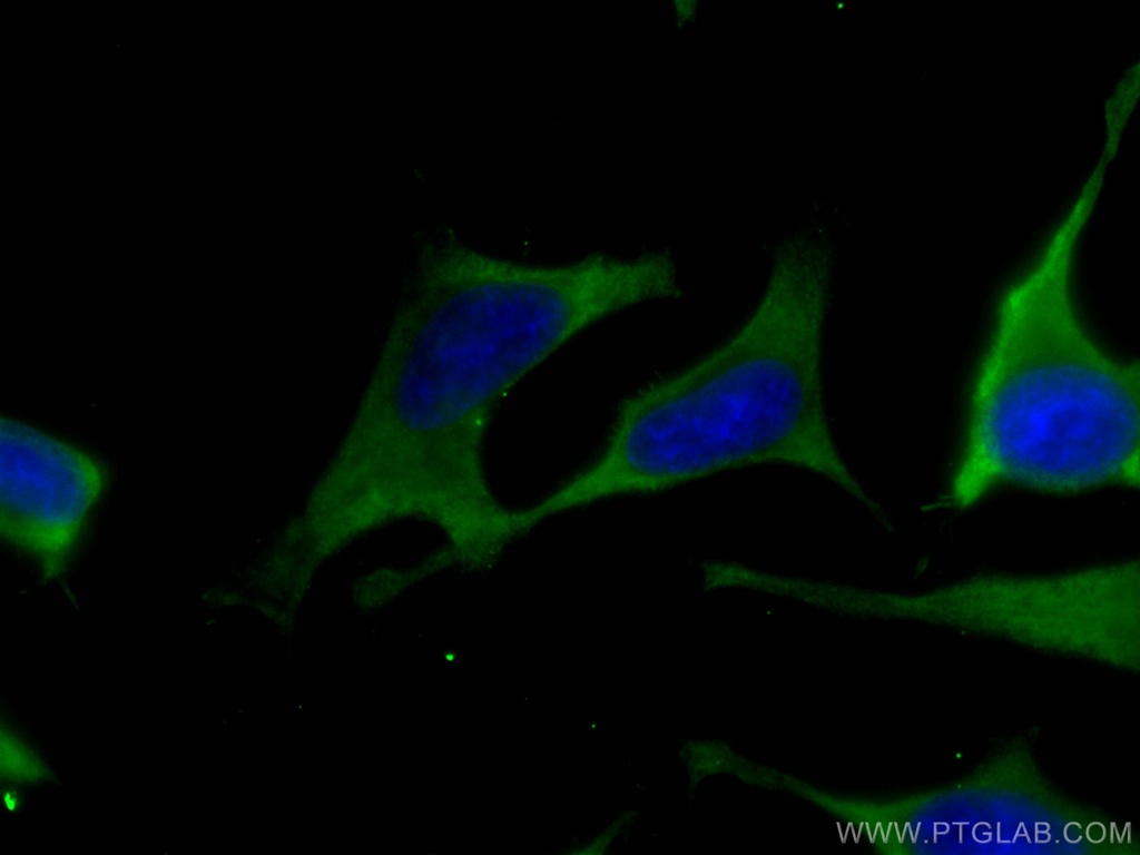 ALDOA Monoclonal antibody
