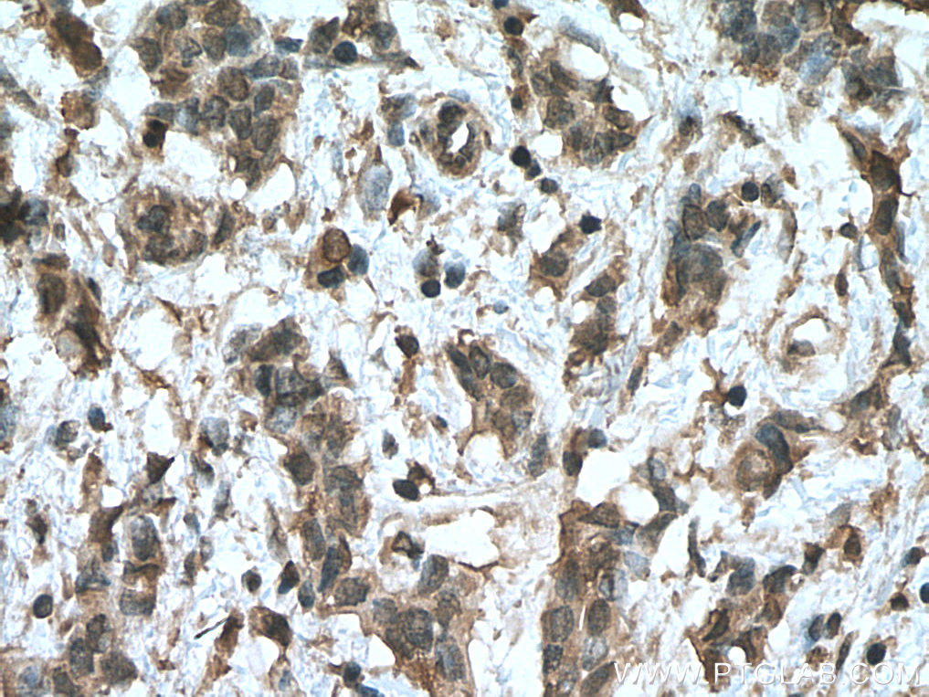 HMBS Monoclonal antibody