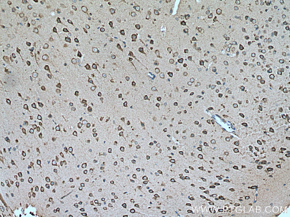 SLC25A12 Monoclonal antibody