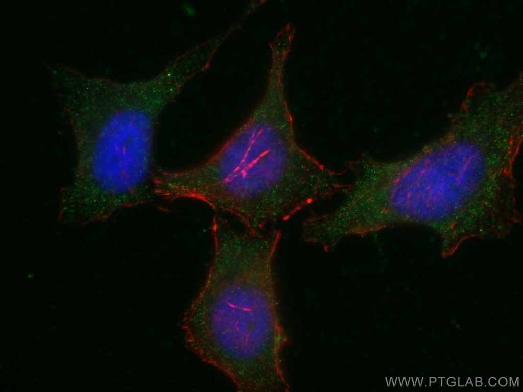 PLCL2 Monoclonal antibody