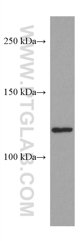 ERAP2 Monoclonal antibody