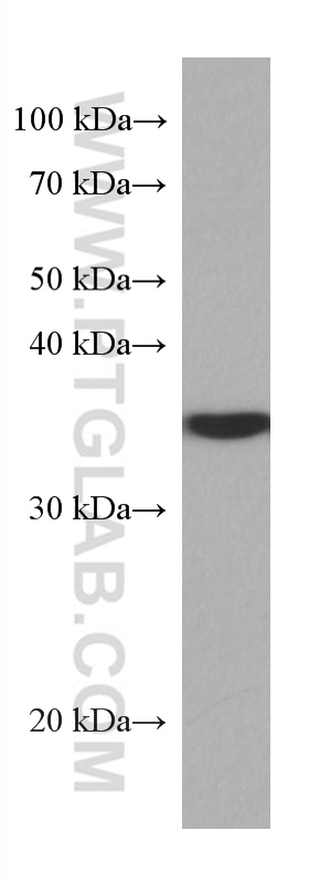 SET Monoclonal antibody